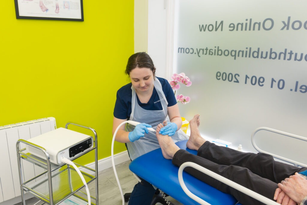 Verruca Treatment & Removal Dublin