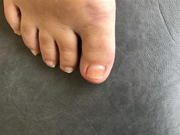 patient 1 after