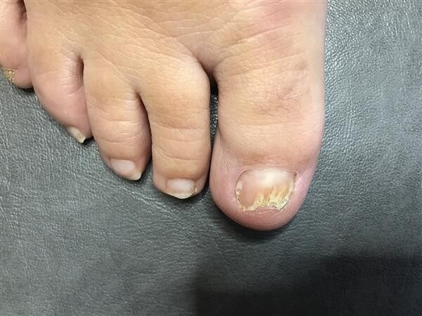 patient 1 before