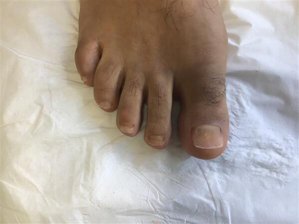 patient 2 after