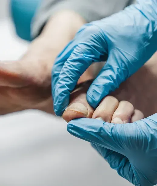 Ingrown Toenail Removal & Removal Dublin