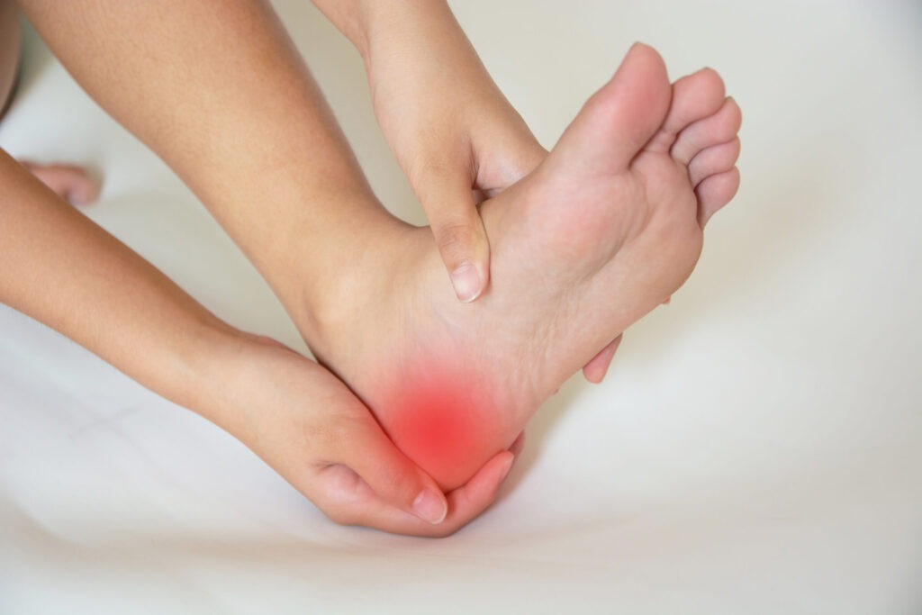 Why Does My Heel Hurt? 1 AdobeStock 258641026